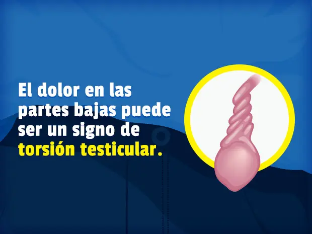 tuerce algo a un lado - Qué mueve o tiene virtud para mover